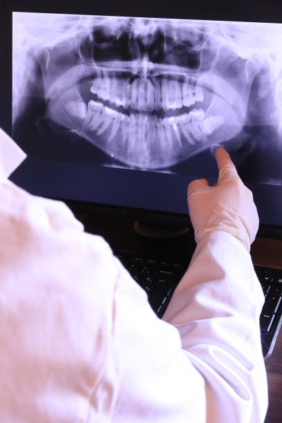Tooth Infection Emergency Dentist in NM